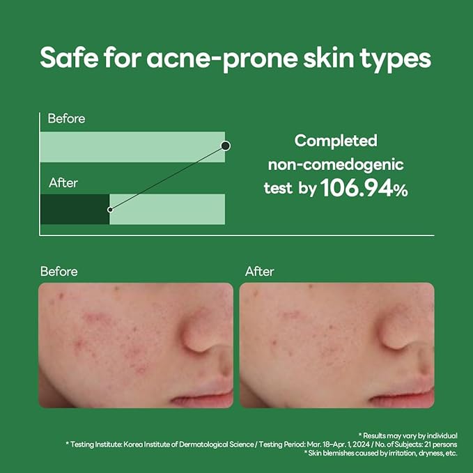 Mediheal Teatree Calming Serum 1.35 fl.oz - Skin Calming and Sebum Care & Deep Moisturization - with Hyaluronic Acid
