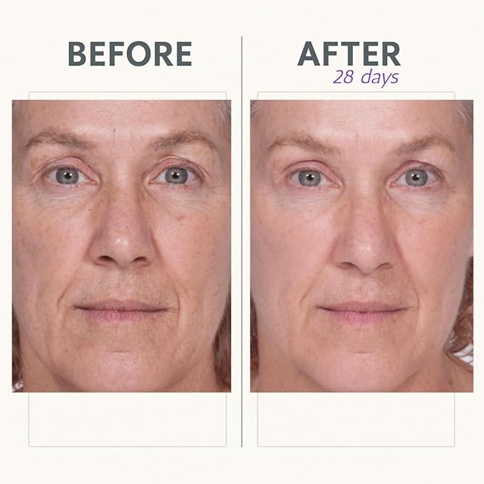 Reverse Lift Firming Facial Serum, Visibly Firm, Tone & Tighten Skin, Hydrating Anti-Aging Peptides, Reduce Wrinkles, Sagging Face and Neck, Serious Skincare, 1 oz