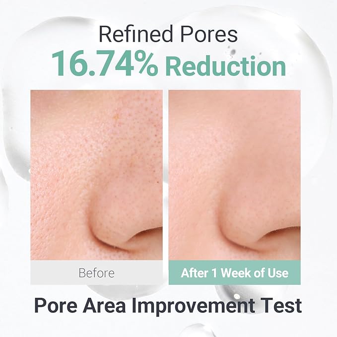 Soothing Calm Toner Pad, Daily Gentle Exfoliating & Hydrating Facial Pads for Intense Soothing Care, Heartleaf Extract and CICA for Sensitive Skin Safe, Korean Skincare (60 Pads)